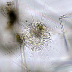 Actinosphaerium eichhornii