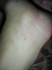 Trichomyrmex destructor