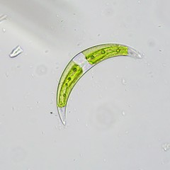 Closterium leibleinii