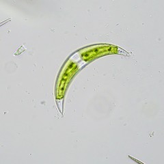 Closterium leibleinii