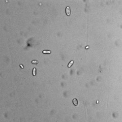 Hypomyces boletiphagus