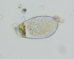 Hyalosphenia