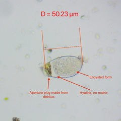 Hyalosphenia