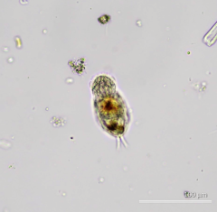 Cephalodella ventripes