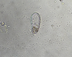 Euglyphidae
