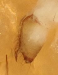 Psilochorus apicalis