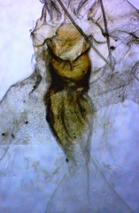 Xanthotype urticaria