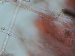 Trechispora mollusca