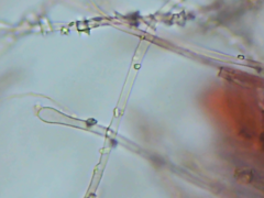 Trechispora mollusca