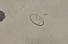Cocconeis