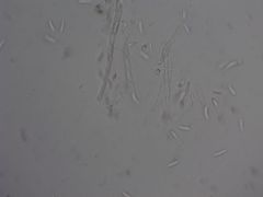 Mitrula lunulatospora