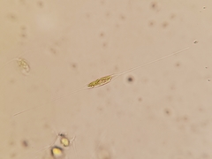 Cylindrotheca closterium