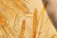 Arachnopeziza trabinelloides