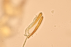 Arachnopeziza trabinelloides