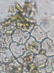 Pseudopediastrum boryanum
