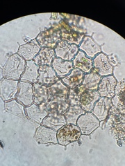 Pseudopediastrum boryanum