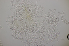 Ramularia glechomatis