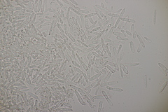 Ramularia glechomatis