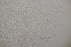 Ramularia glechomatis