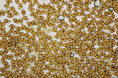 Puccinia adoxae