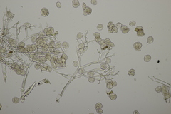 Peronospora arvensis