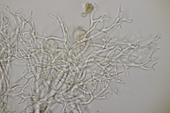 Peronospora arvensis