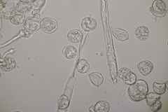 Bremia lapsanae
