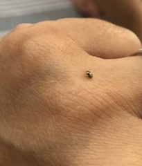 Psyllobora bicongregata