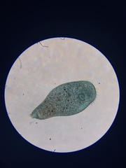 Stentor coeruleus