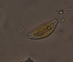 Encyonema leibleinii