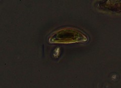 Encyonema leibleinii