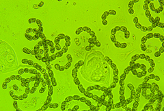 Dolichospermum lemmermannii