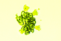 Dolichospermum lemmermannii