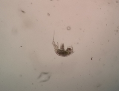 Microsetella