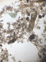 Stentor coeruleus