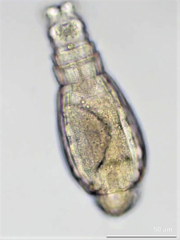 Habrotrocha constricta