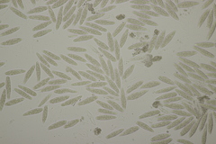 Botryosphaeria quercuum