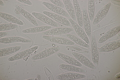 Botryosphaeria quercuum