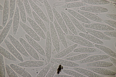 Botryosphaeria quercuum