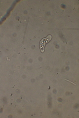 Hartmannellidae