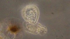Strobilidium
