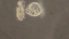Strobilidium