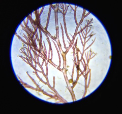 Callithamnion acutum