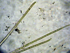 Phormidium nigroviride