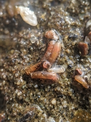 Caecum dextroversum