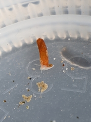 Caecum dextroversum