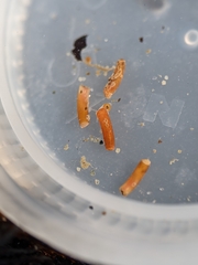Caecum dextroversum