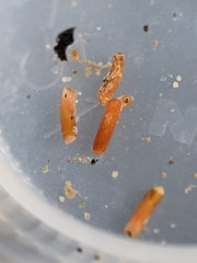 Caecum dextroversum