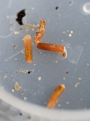 Caecum dextroversum