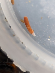 Caecum dextroversum